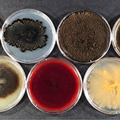 petri dishes with samples